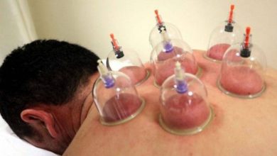 Hacamat Yapılmadan Önce Alkol İle Temizlenmesi