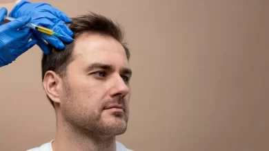 Saç Ekerek Para Kazanmak Helal mi?