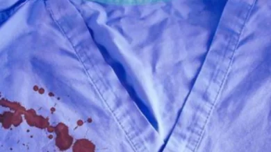 Kan Lekesi Namaza Engel Olur mu?